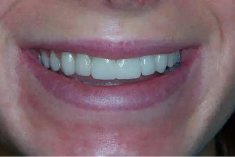 Elmhurst Smiles Elmhurst Smiles