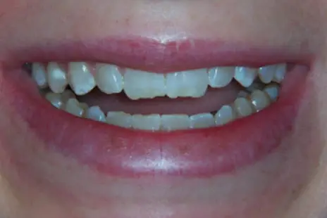 Elmhurst Smiles Elmhurst Smiles